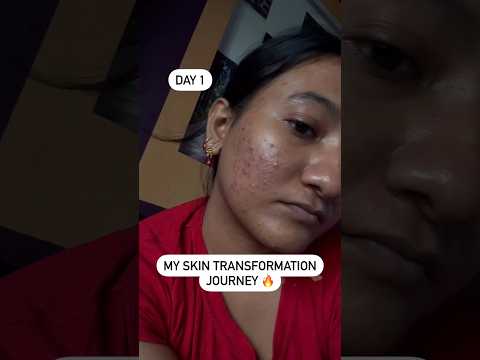 Are you worried about tanning and pigmentation? No worries | #woodoo #facewash #skincare