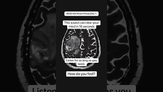 852 Hz Frequency Pure Tone Meditation