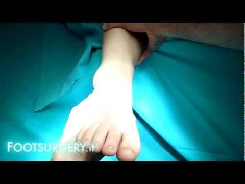 Mal di schiena acuto come cura rapida Dolore alla schiena tra le scapole e al petto