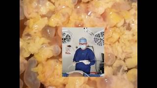 Biopolímeros: ¿Qué son y cómo se forman