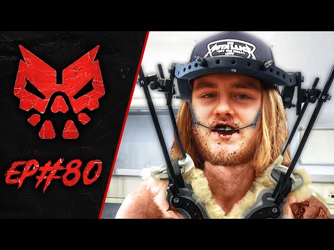 Soup had busted teeth as a kid - GOONS #80