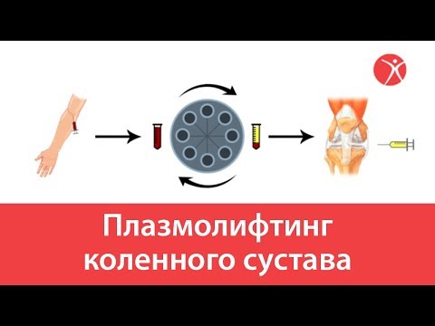 При остеохондрозе на турнике Боль и жжение в левом коленном суставе