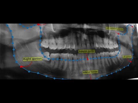 Applying Deep Learning to biomedical image analysis