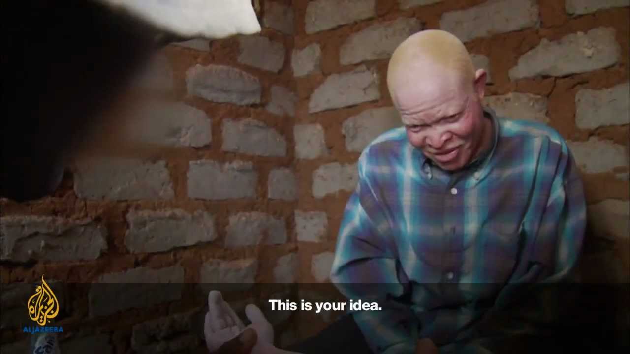 The Spell of the Albino