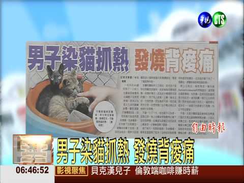 男子染貓抓熱 發燒背痠痛