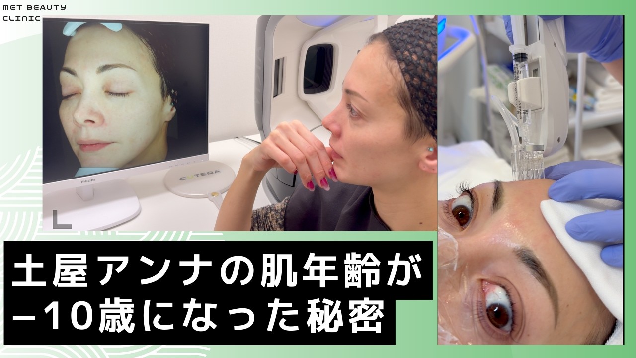 【肌年齢】実は！日焼け止めを塗らない土屋アンナの肌質「完全改善」