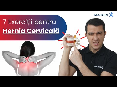 Exerciții pentru ceafă tensionată