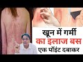 पित्ती उछलने से खुजली हो जाती है Khoon Me Garmi 