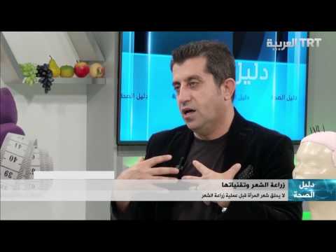 زراعة الشعر عند النساء