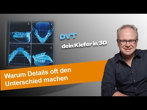 Das DVT - Dein Kiefer in 3D - oder wie man die schlimmsten Fehler vermeidet