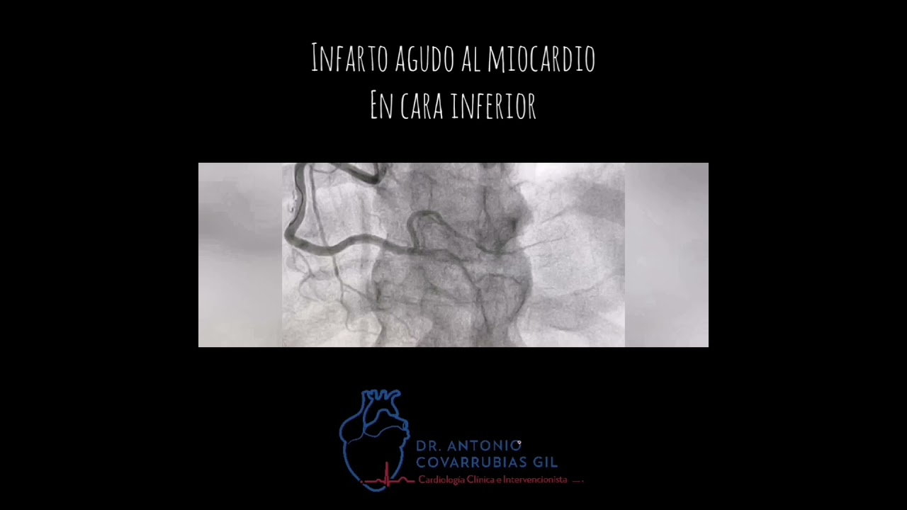 Antonio Covarrubias Gil-47