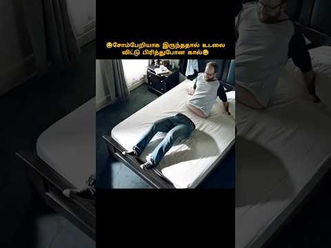 😂சோம்பேறியாக இருந்ததால் உடலைவிட்டு பிரிந்துபோன கால்😂 #shorts