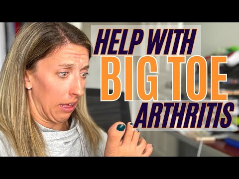 Top 4 Movements for RELIEF from HALLUX RIGIDUS or HALLUX LIMITUS | Big Toe stiffness