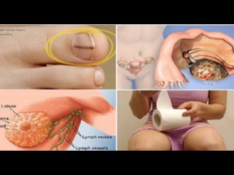 Kung gaano kabisa ang target para sa pagbaba ng timbang Slimming may mainit na paminta recipe