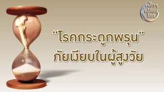โรคกระดูกพรุน ภัยเงียบในผู้สูงอายุ