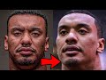 Larry Wheels Face On Vs. Off Anabolic Steroids 😳