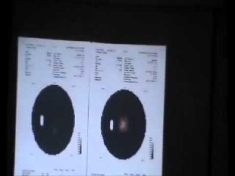 2011 Retinitis Pigmentosa Association - Holland Part3