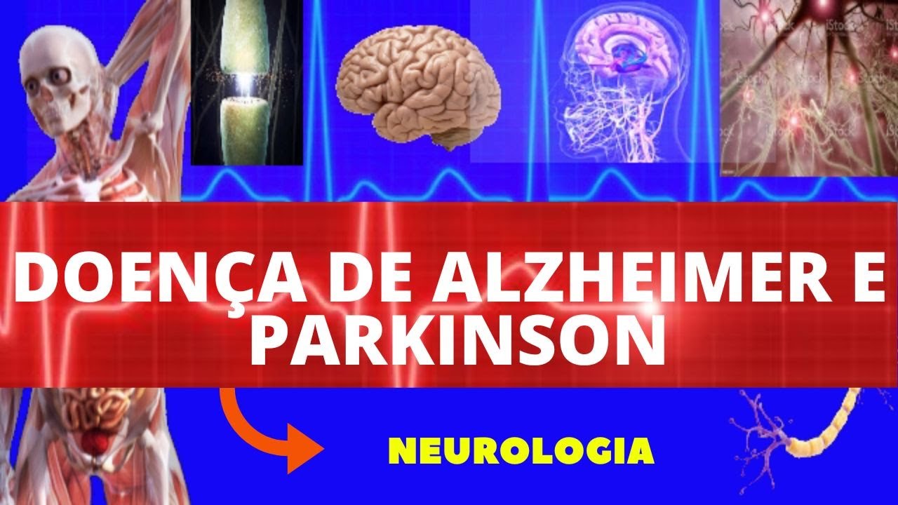 DOENÇA DE ALZHEIMER E PARKINSON - (CAUSAS, SINTOMAS, DIAGNÓSTICO E TRATAMENTO) - NEUROLOGIA