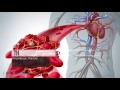 When Is Spleen Removal Necessary?