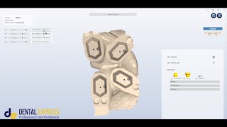 Step-by-step process of using IOconnect from TruAbutment in intra-oral scanning