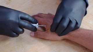 ABC NEWS: PEOPLE ALL OVER WORLD BEING IMPLANTED WITH RFID CHIP (MARK OF THE BEAST)