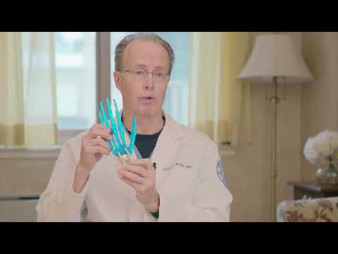 Image - HSS Minute: KinematX Total Wrist Replacement