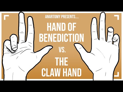 Hand of Benediction vs the Claw Hand [feat. the Ulnar Paradox]