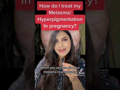 Pregnancy and Melasma?