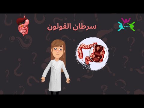 Mieux vaut prévenir que guérir – Épisode 2 – Cancer du côlon