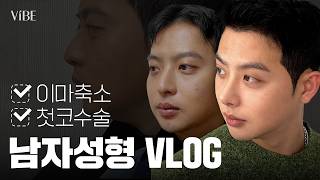 상담부터 전후비교까지 코성형, 이마축소 고민하는 남자분들 여기보세요｜남자 성형 브이로그