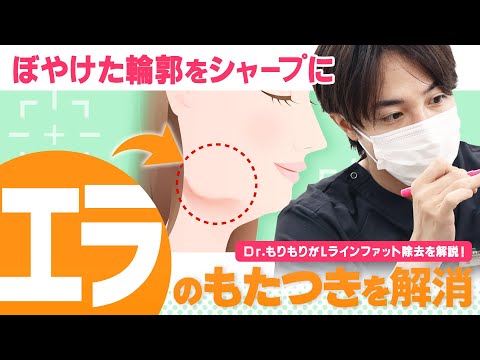 【小顔整形】”Lラインファット”って何？エラのたるみ・もたつきを解消する施術を解説！【Dr.もりもり】