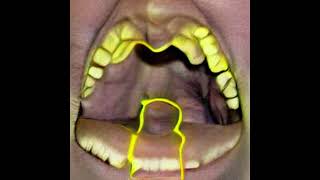 Download lagu Anti Fuckers Core - My Yellow Piss In Your Mouth mp3 Download lagu Anti Fuckers Core - My Yellow Piss In Your Mouth mp3