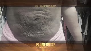 12 mujeres fueron en busca de la belleza y salieron deformadas tras pasar por centro Stefani Stetic