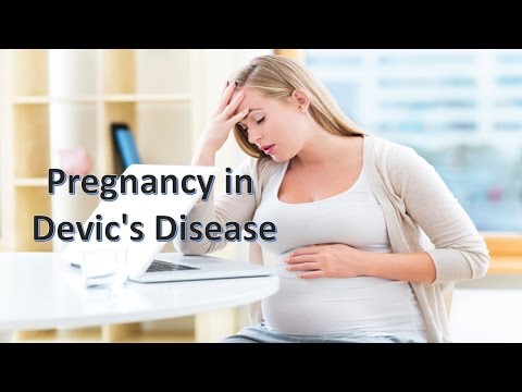 Devic's disease in Pregnancy