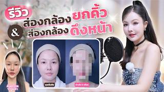 รีวิวส่องกล้องยกคิ้ว & ส่องกล้องดึงหน้า & ศัลยกรรมปากแมว | erk-erk