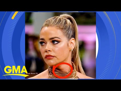 download lagu mp3 mp4 Denise Richards Thyroid Pic, download lagu Denise Richards Thyroid Pic gratis, unduh video klip Denise Richards Thyroid Pic
