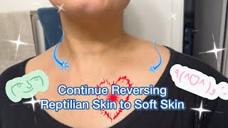 Continue Reversing Reptilian Skin to Soft Skin | Curly Cami Channel 