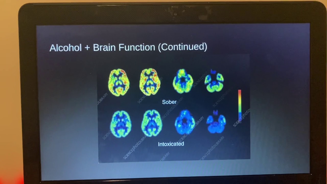 Alcohol Presentation