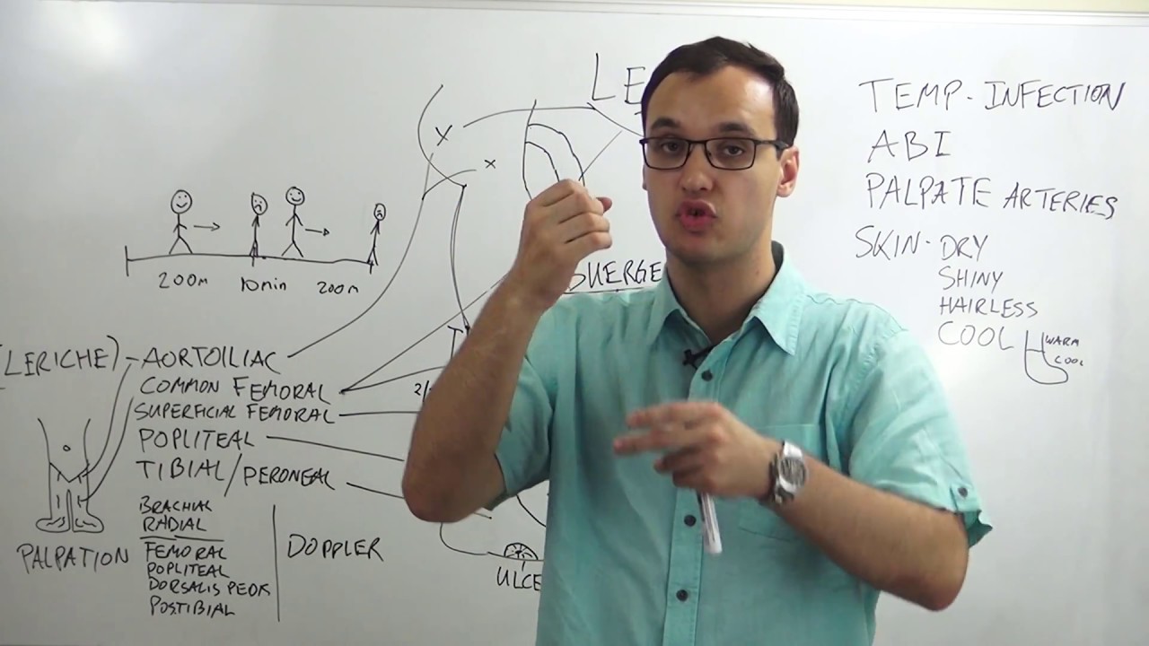 Peripheral artery disease: Symptoms