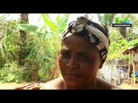 Pains behind the smile