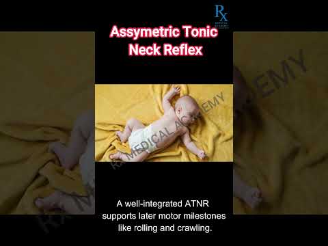 🍼🧠 Asymmetrischer tonischer Nackenreflex (ATNR) – bei Säuglingen auch als „Fechthaltung“ bekannt!