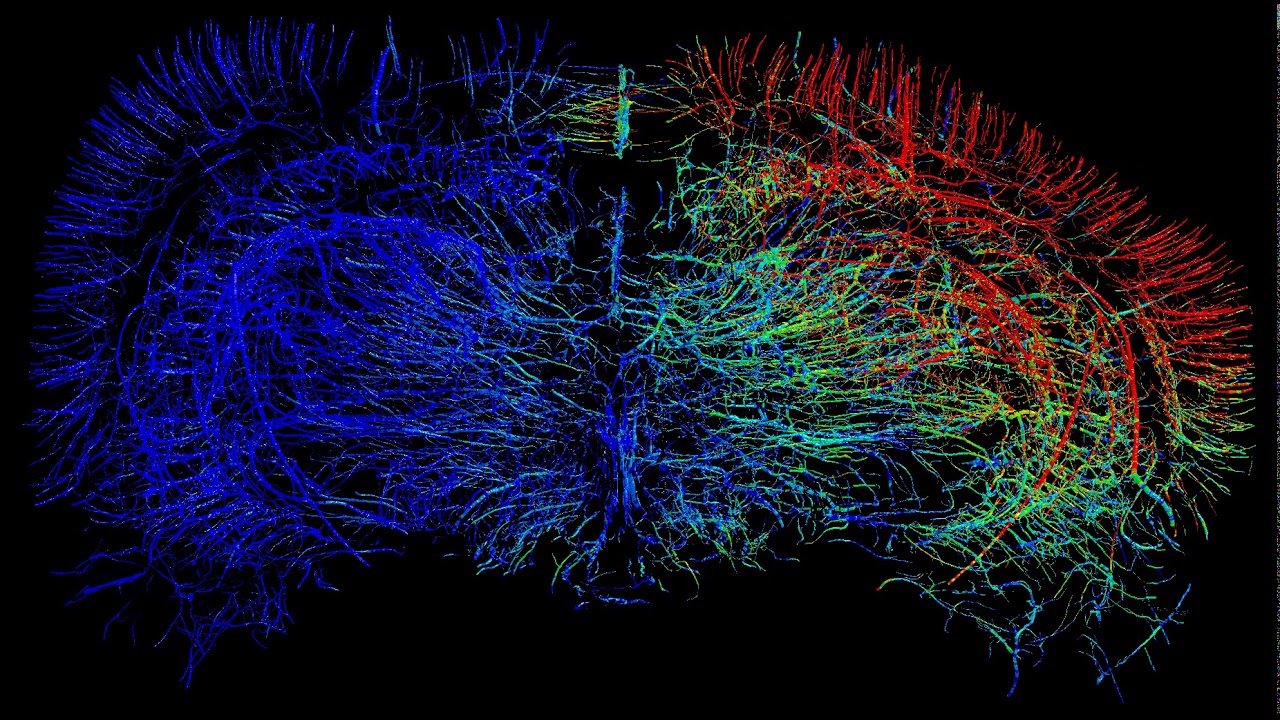 Simulation of stress in the vasculature of the rat brain during impact. V.M. stress: Dark blue: 0; Red: 15 kPa.