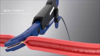 marClamp® Cut IQ | Features and functions