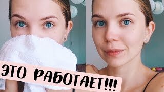Черные точки на носу это