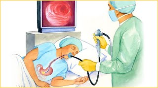 Endoscopic Procedure - Indications, Types, How It Is Done, Risks, And Complications