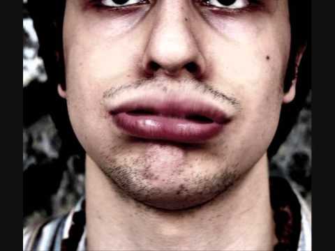 Kaledo - Superfunkee (prod. Shadaloo)