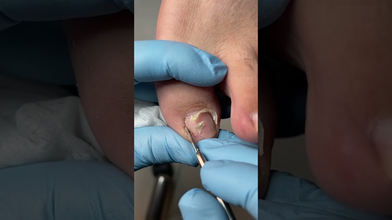 Satisfying Toenail Grooming | Gentle Foot Care Routine  #fypシ #cleannails #RelaxingCare #fypシ