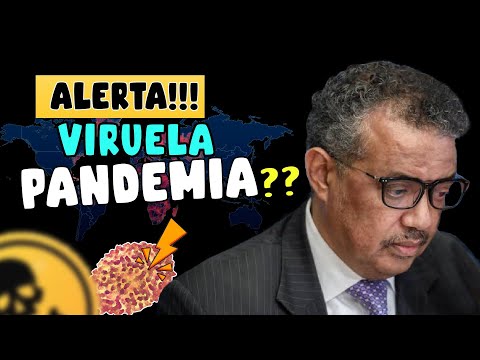 ALERT ⚠️ MONKEYPOX NEXT PANDEMIC? 😱😱😱 WHO CONVENES EXPERT COMMITTEE