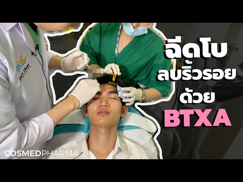 เมโสแฟต ยี่ห้อไหนดี