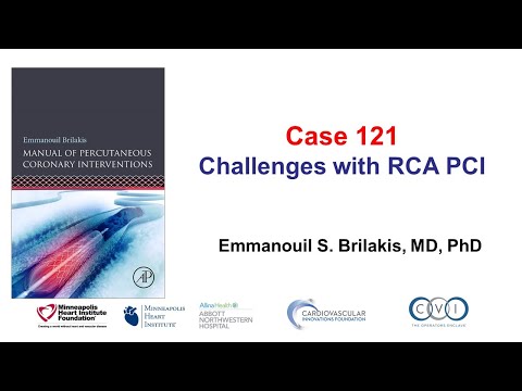 Case 121: PCI Manual - Challenges with RCA PCI